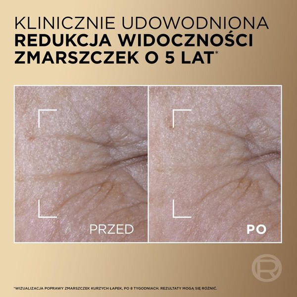 L'Oréal Paris Age Perfect Le Duo  serum do twarzy 30 ml